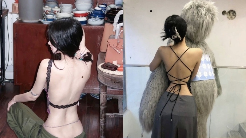 Nốt ruồi ở bả vai hoặc giữa lưng liên quan đến gánh nặng và trách nhiệm