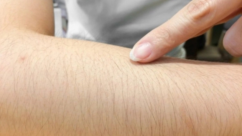 Nguyên nhân thực sự gây ra tình trạng rậm lông?