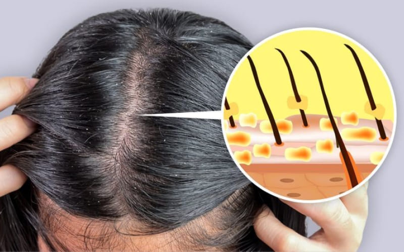 Lựa chọn sản phẩm phù hợp với tình trạng tóc và da đầu