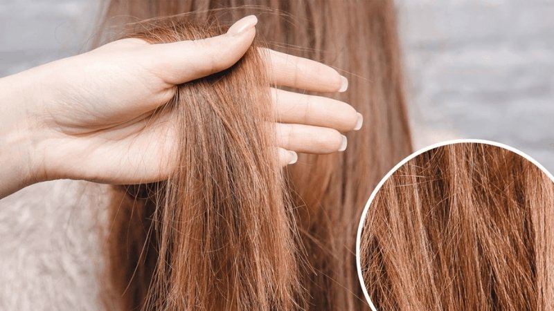 Tóc bị khô xơ, dễ gãy rụng