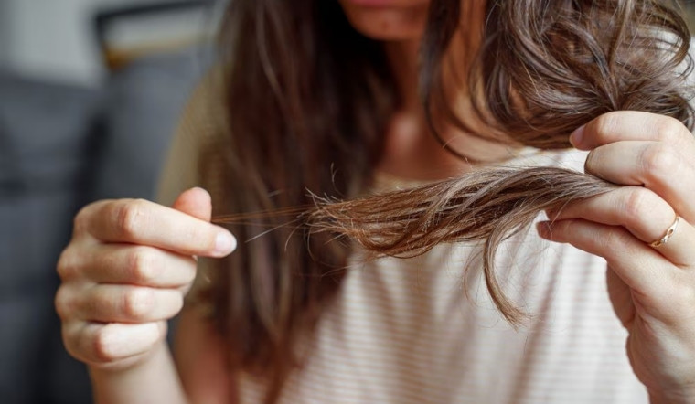 Tóc sâu là gì? Giải mã nguyên nhân và lời khuyên có nên nhổ tóc sâu không
