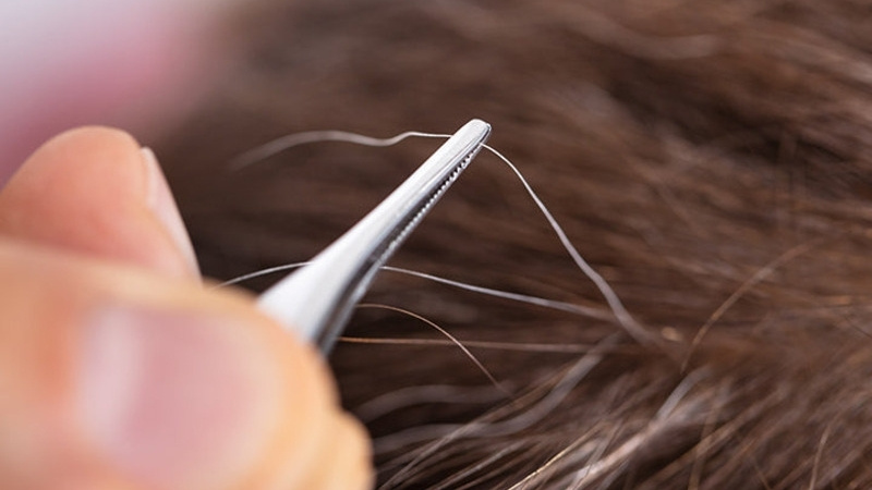 Lời khuyên từ chuyên gia: Có nên nhổ tóc sâu không?