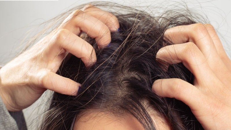 Dấu hiệu nhận biết tóc sâu chính xác nhất