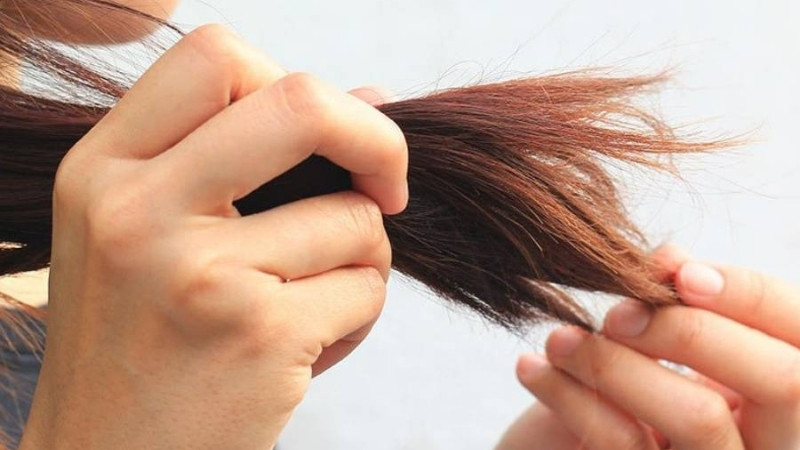 Các câu hỏi liên quan (FAQs)