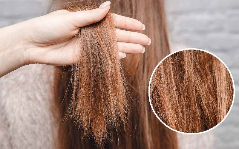 Nguyên nhân chính gây ra tình trạng tóc rễ tre