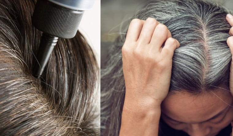 Tóc bạc ngả vàng: Nguyên nhân và 7 cách khắc phục để tóc trắng sáng trở lại