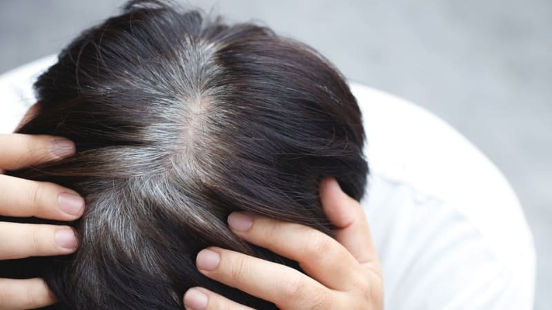 Tóc bạc sớm kèm mệt mỏi, rụng tóc nhiều cần thăm khám ngay