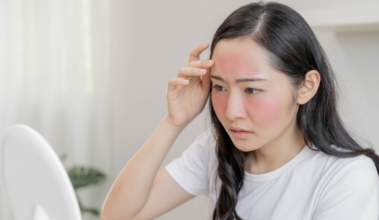 Hướng dẫn chăm sóc da sau khi đi nắng để phục hồi và làm dịu tức thì