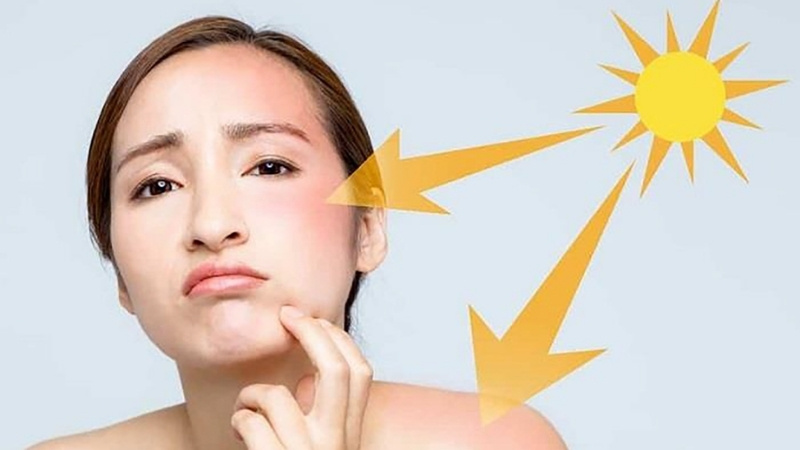 Thời tiết mùa hè khiến da bết dính, khô sạm