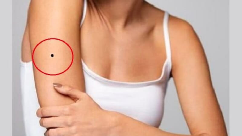 Nốt ruồi ở tay phải Nốt ruồi ở tay phải