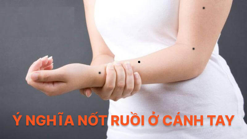 Ý nghĩa nốt ruồi ở cánh tay Ý nghĩa nốt ruồi ở cánh tay