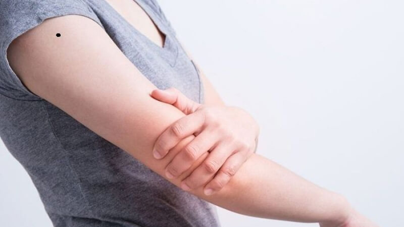 Nốt ruồi ở bắp tay Nốt ruồi ở bắp tay