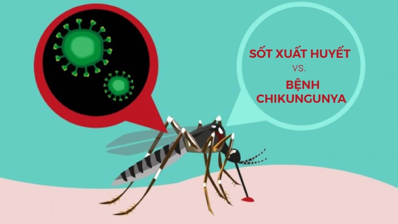 So sánh triệu chứng Chikungunya và Sốt xuất huyết