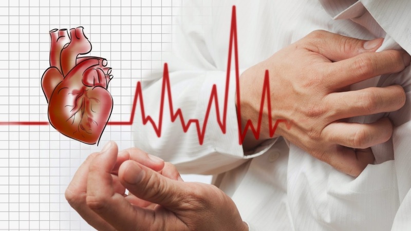 Viêm cơ tim là biến chứng cấp tính của bệnh Chikungunya