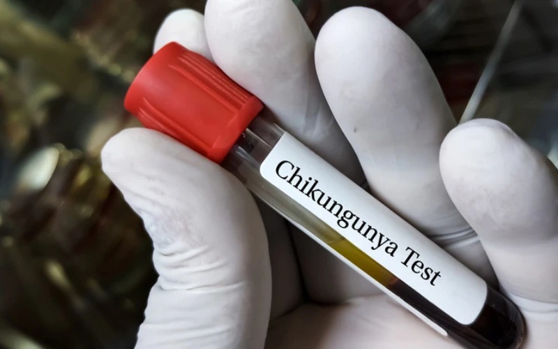 Hiện chưa có thuốc đặc trị cho Chikungunya