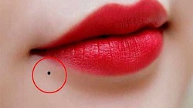 Nốt ruồi dưới môi bên trái