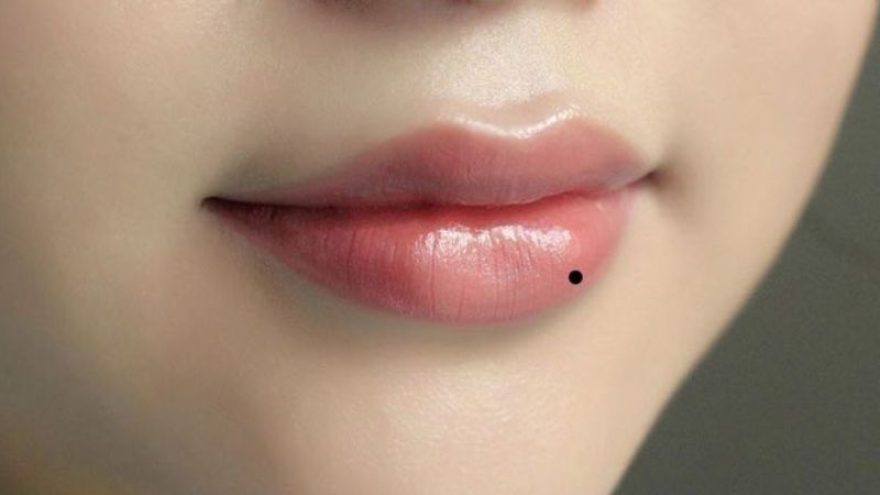 Nốt ruồi son dưới môi