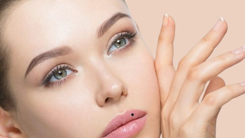 Nốt ruồi son ở môi trên