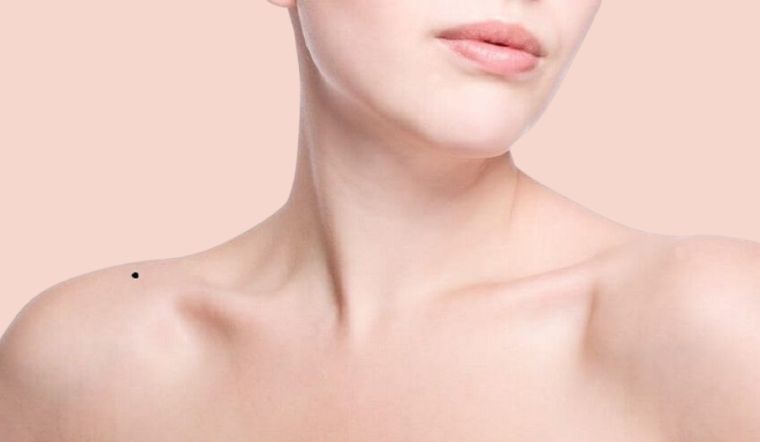 Nốt Ruồi Ở Bả Vai Phải Nữ