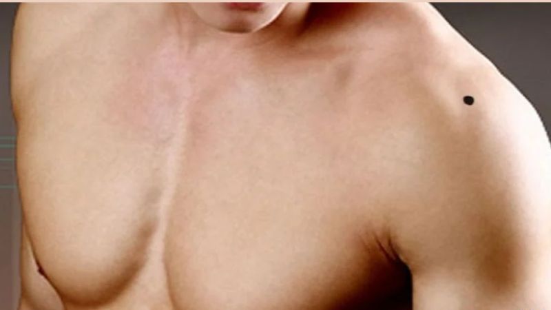 Nốt Ruồi Ở Vai Bên Trái Nữ