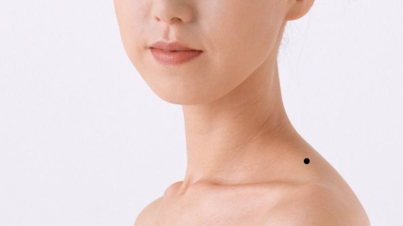 Nốt ruồi ở đầu bả vai Nốt ruồi ở đầu bả vai
