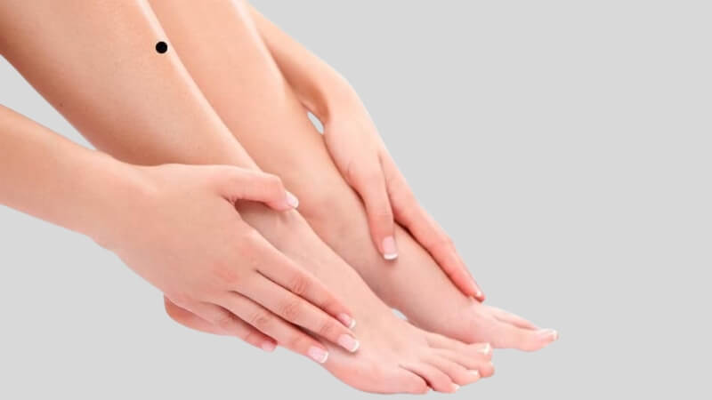 Nên tẩy nốt ruồi nếu nó ảnh hưởng đến ngoại hình, gây mất tự tin Nên tẩy nốt ruồi nếu nó ảnh hưởng đến ngoại hình, gây mất tự tin