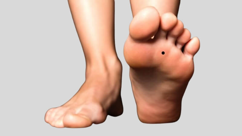 Nốt ruồi ở lòng bàn chân Nốt ruồi ở lòng bàn chân