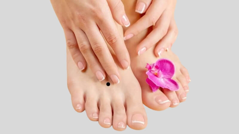 Nốt ruồi ở mu bàn chân Nốt ruồi ở mu bàn chân