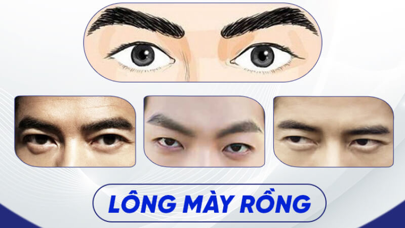 Lông mày rồng của nam giới Lông mày rồng của nam giới