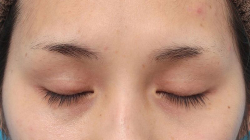 Những tướng lông mày xấu theo phong thủy có thể làm giảm vận khí