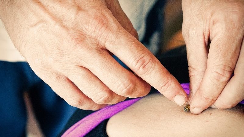 Hãy sơ cứu và điều trị y tế khi bị ong đốt