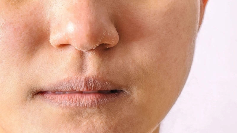 Da không đủ ẩm Da không đủ ẩm