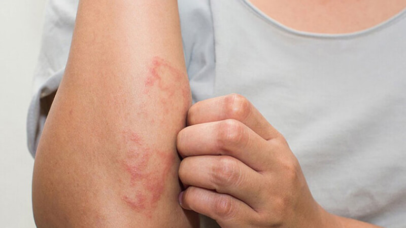 Xử lý khi phát hiện kiến ba khoang Xử lý khi phát hiện kiến ba khoang