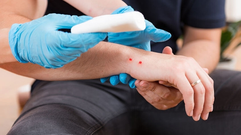 Làm gì khi gặp hoặc bị rắn lục xanh cắn?