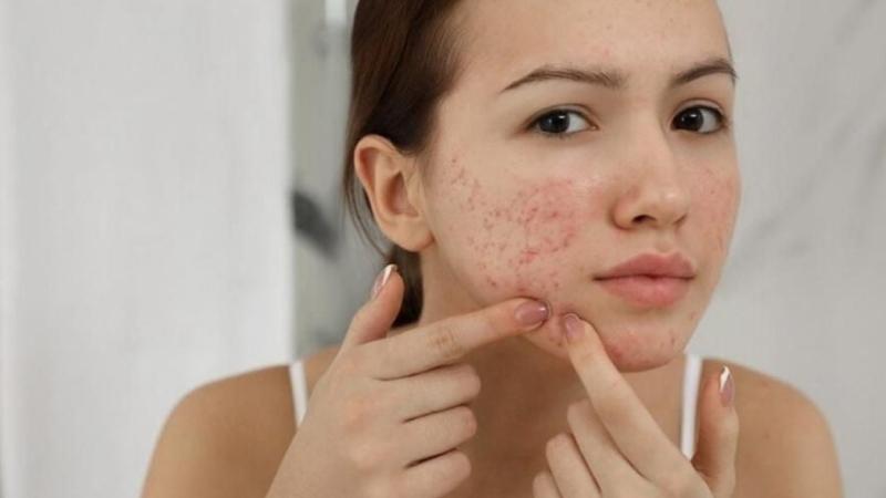 Phấn nền có hại cho da không? Phấn nền có hại cho da không?