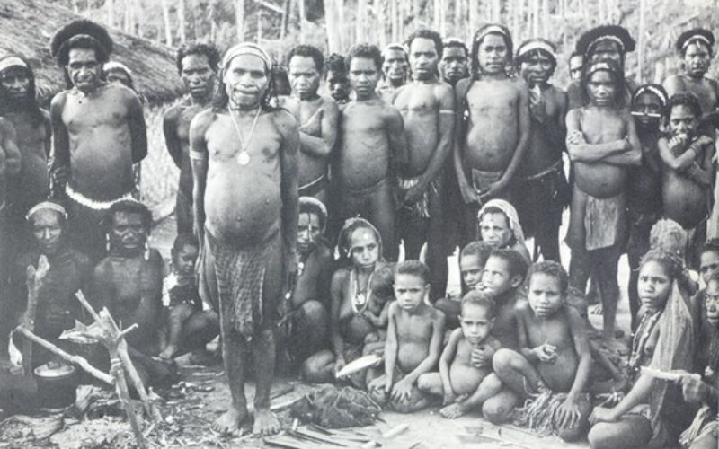 Bệnh Kuru xuất phát từ tục ăn thịt người trong tang lễ bộ tộc Fore, Papua New Guinea Bệnh Kuru xuất phát từ tục ăn thịt người trong tang lễ bộ tộc Fore, Papua New Guinea