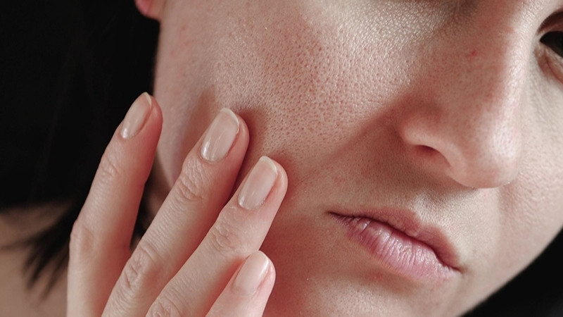 Bề mặt da khô ráp Bề mặt da khô ráp