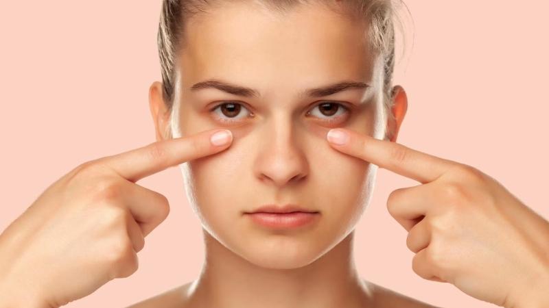 Vì sao thức khuya khiến mắt bị sưng?