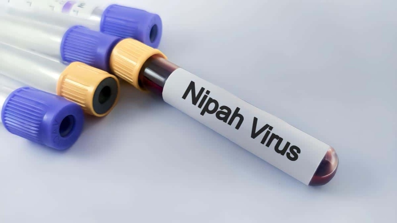Chẩn đoán và Điều trị virus Nipah (Cập nhật 01/2026)