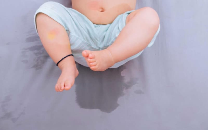 Vết nước tiểu trẻ em hoặc thú cưng