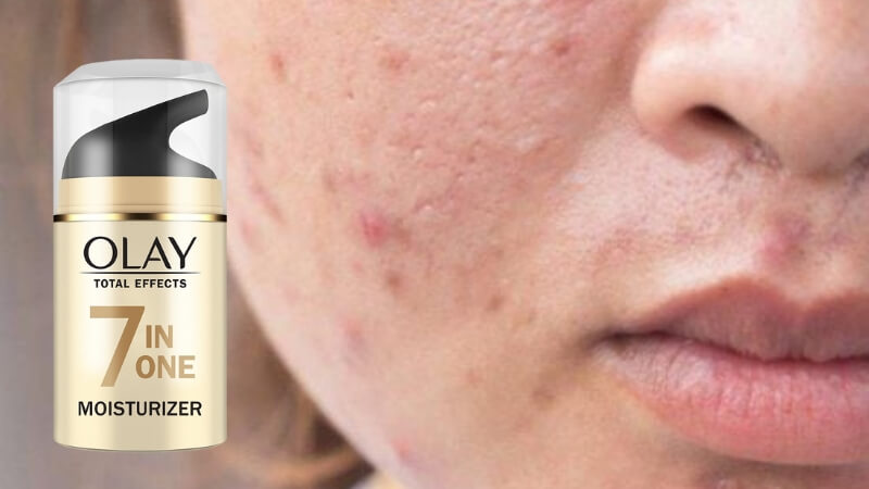 Olay Total Effects 7 in 1 (Bản thường)