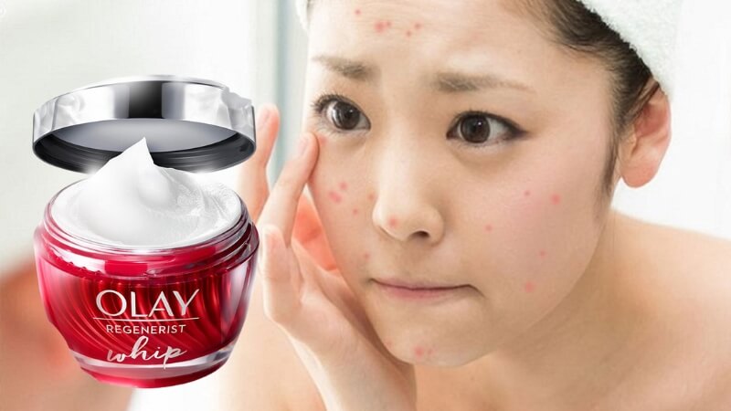 Các bước skincare kết hợp (Routine gợi ý)