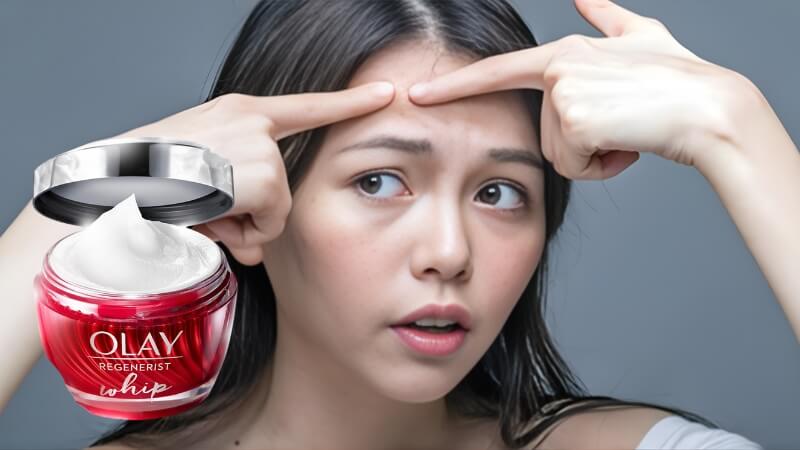 Câu hỏi thường gặp về kem Olay và da mụn