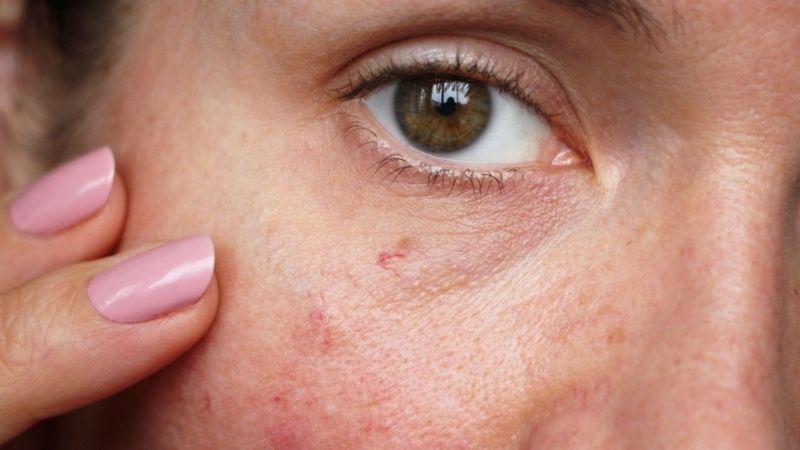 Da nhạy cảm do cơ địa bẩm sinh, da tổn thương do tác động từ bên ngoài