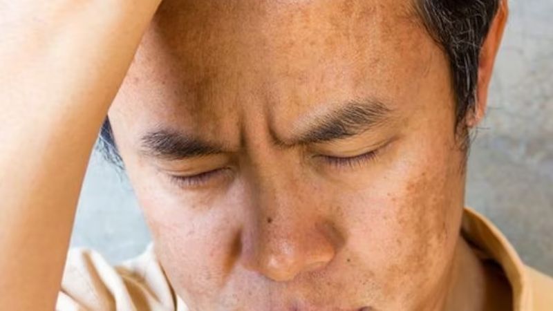 Vì sao nam giới thường có làn da sạm màu?