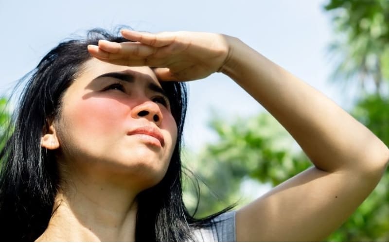 Da cần thời gian để phục hồi sau cháy nắng