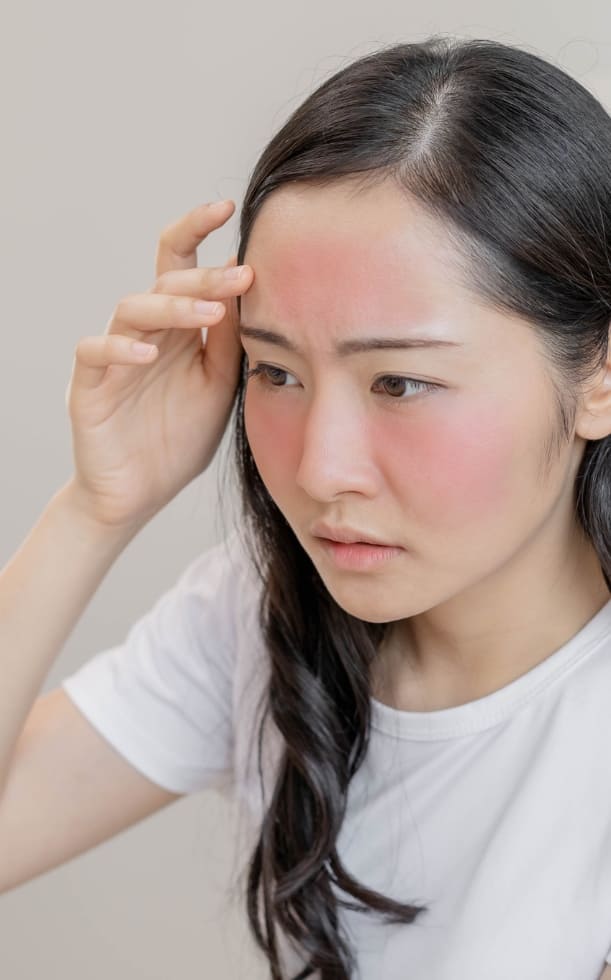 Da mặt bị cháy nắng làm sao để trắng lại? Cách phục hồi da bị cháy nắng nhanh