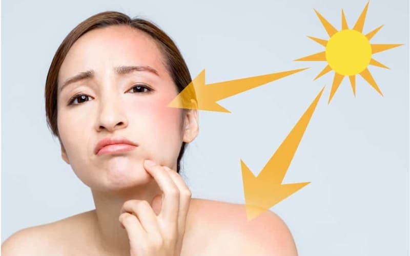 Da dễ bị tổn thương khi phơi nắng lâu