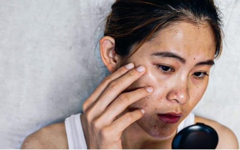 Nhiều thói quen sai khiến da khó phục hồi