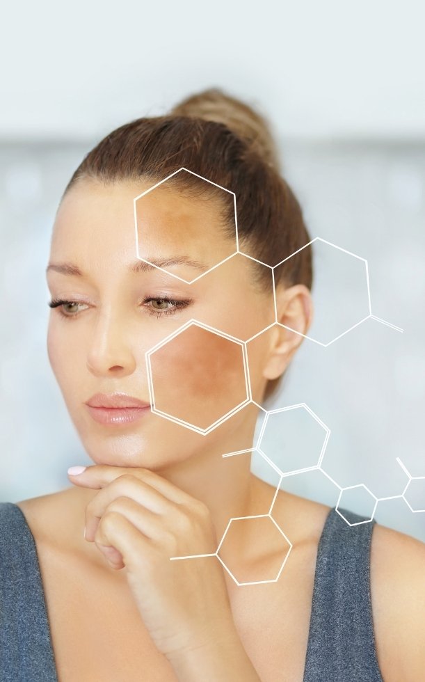 Da nổi đốm đen: Nguyên nhân, dấu hiệu và cách khắc phục hiệu quả